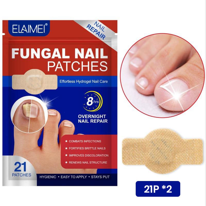Schimmelnagelplekken